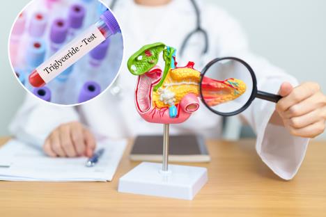 pankreas pod lupom lekara/epruveta na kojoj piše trigliceridi