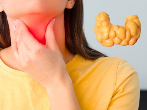 žena u žutoj majice se drži za grlo u predelu štitne žlezde, model štine žlezde pored