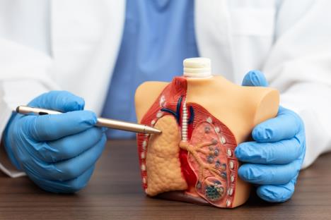 pluća plućna embolija