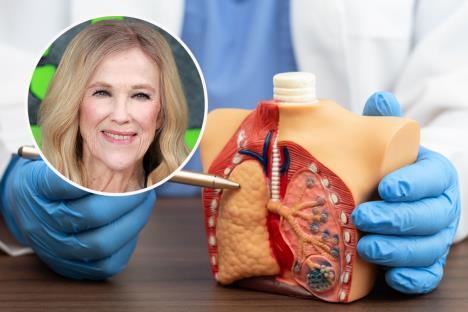 Ketrin O’Hara/doktor pokazuje na model pluća