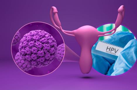 maketa vagine/hov virus/hpv vakcina