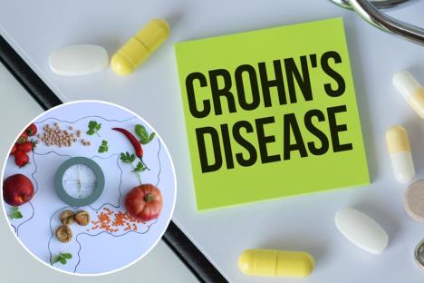 intervalni post kronova bolest varenje