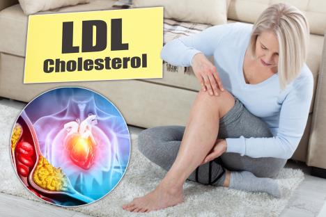 holesterol/oticanje nogu