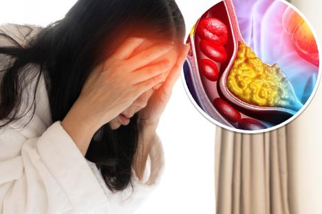 žena sa bolom u glavi se drži za čelo/krvni sud sa naslagama holesterola