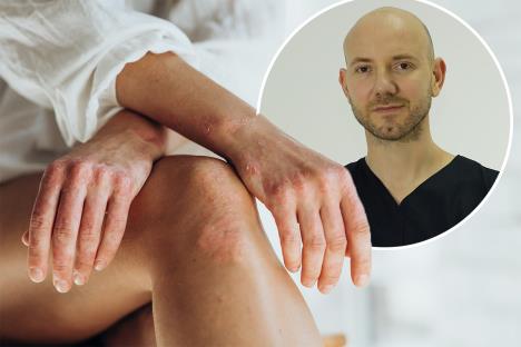 Psorijaza/Dr Ivica Jeremić