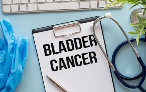 dijagnoza rak bešike ispisana na papiru stoji na stolu pored sterostkopa