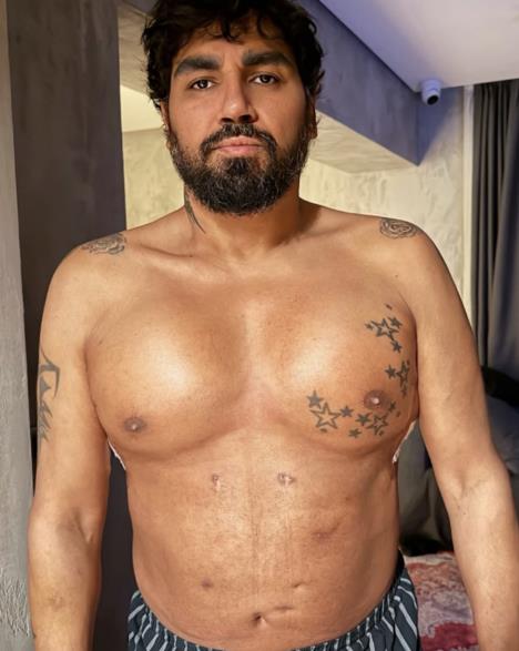 Azis pokazao silikone