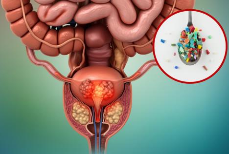 rak prostate/mikroplastika