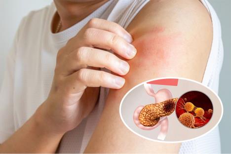 ženska osoba u ebloj majci češe levo rame / rak pankreasa