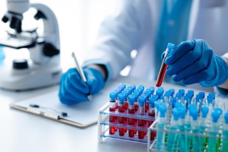 zdravstveni radnik u belom mantilu i plavim higijenskim rukavicama drži epruvetu sa uzorkom krvi i zapisuje detalje na papir