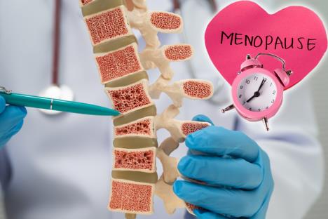 model kičme zahvaćen osteoporozom/srce sa satom na kome piše menopauza