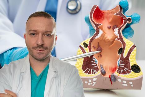 dr Mladen Milošević, hemoroidi