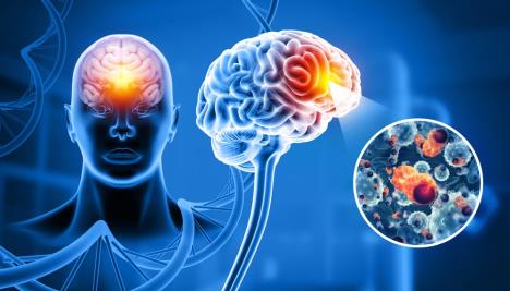 ilustracija mozga i alchajmerove bolesti