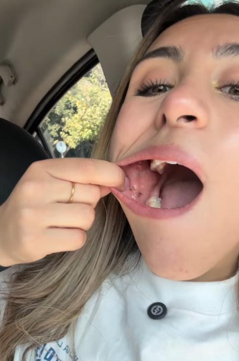 posledice takosa sa tarantulom.PNG