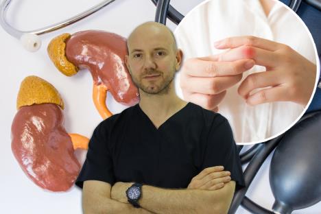 Ivica Jeremić/giht/bubrezi