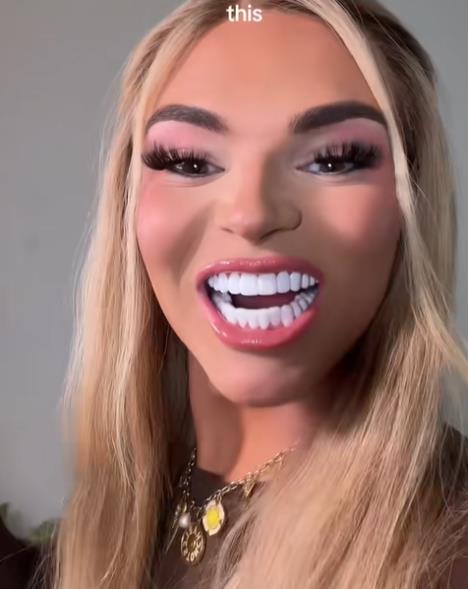 Uradila veštačke zube