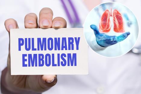 dijagnoza plućne embolije/prikaz pluća