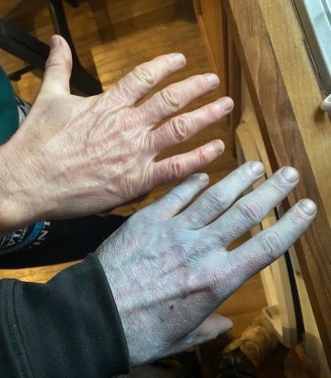 Muškarac sa plavom bojom kože nakon spavanja u novoj posteljini (1).PNG