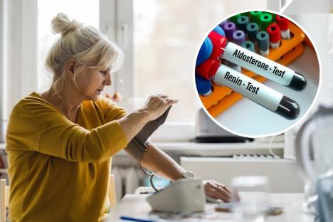 aldosteton merenje pritiska