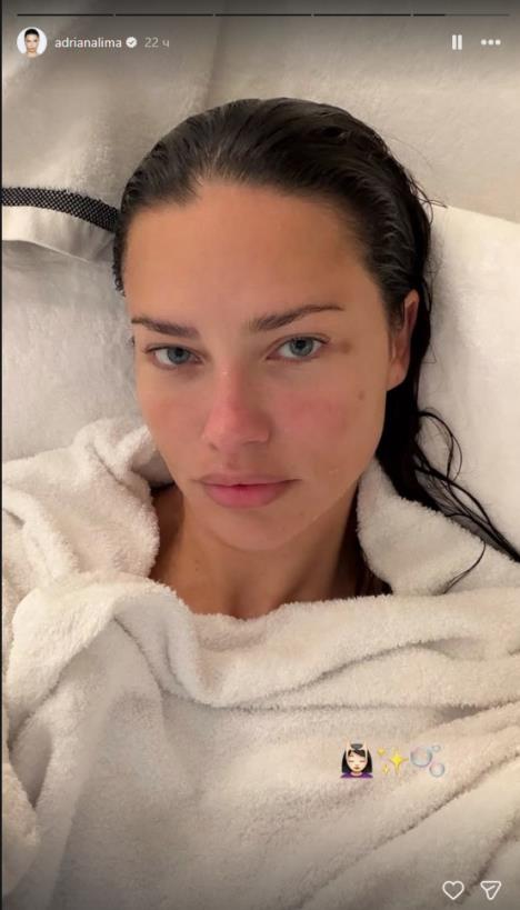 Adrijana Lima bez šminke i filtera