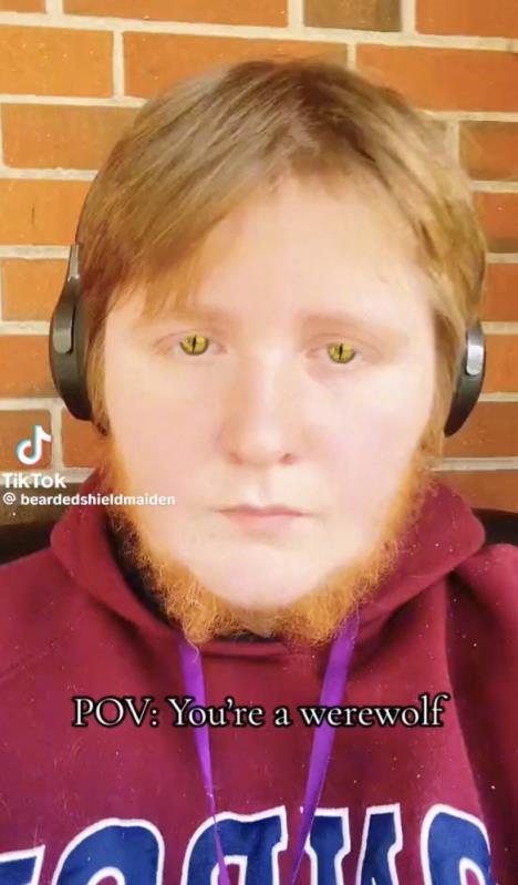 Megan Rajli Nili-Stivenson iz Tenesija ponosno pokazuje bradu koju ima zbog hirsutizma