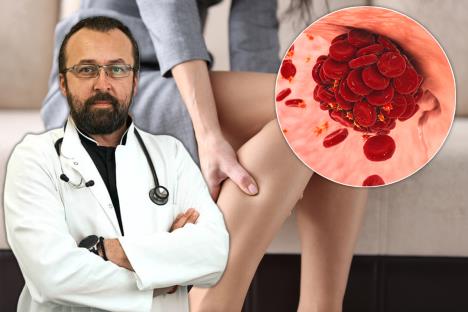 dr Svetislav Mališić/žena koja drži za bolan list noge/tromb