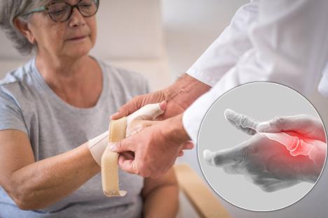 doktor stavlja zavoj na oboleli palac - artritis