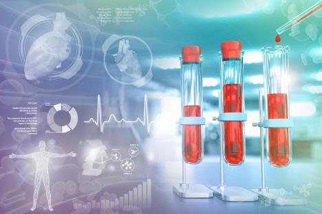 epruvete sa uzorcima krvi za analize