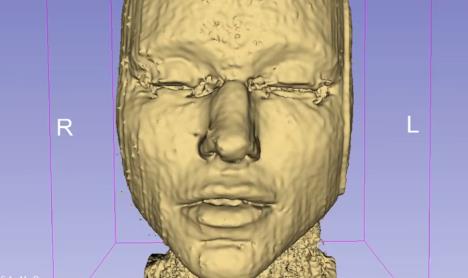 fileri, magnetna rezonanca