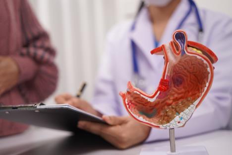 prikaz želuca pod upalom