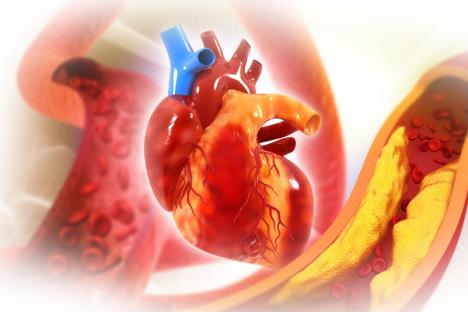 grafički prikaz srca i krvnih sudova sa holesterolom