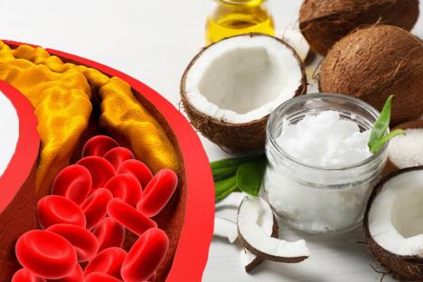 kokosovo ulje/srce/holesterol