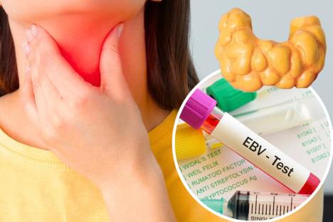 žena se drži za prednju starnu vrata/štitna žlezda/epruveta na kojoj piše Epštajn-Bar virus