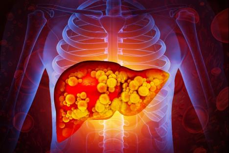 masna jetra ilustracija