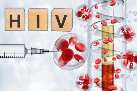 hiv matične ćelije