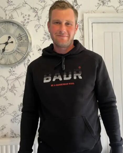 Džon Denton ostao bez zuba u Turskoj (9).png