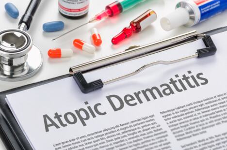 atopijski dermatitis dijagnoza