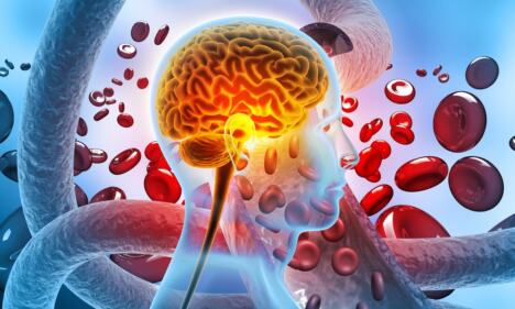 alchajmerova bolest test krvi mozak