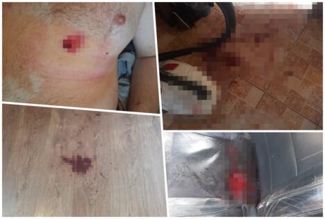 Šid maloletnica izbola mladića