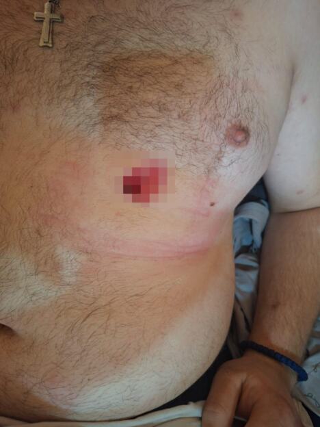 Šid maloletnica izbola mladića