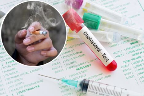 epruveta na kojoj piše holesterol test/ruka žene koja puši