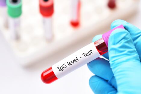 ruka laboranta sa epruvetom na kojoj piše IgG test