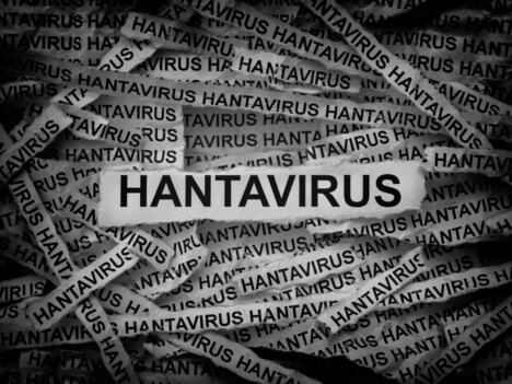 hantavirus