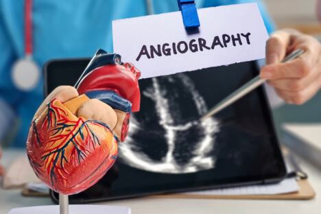 Angiografija 2.jpg