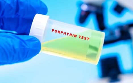 test za porfiriju