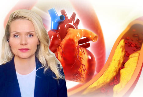 Aleksandra Lišanin/srce i holesterol u krvnom sudu