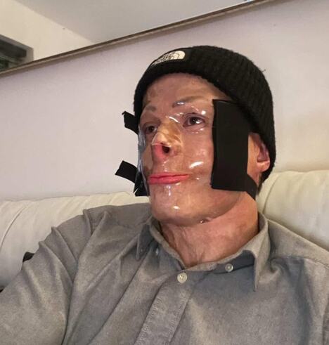 Daren Heris preživeo jak strujni udar