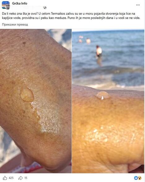 meduze larve kao kapljice vode peckaju kupače u moru u Grčkoj