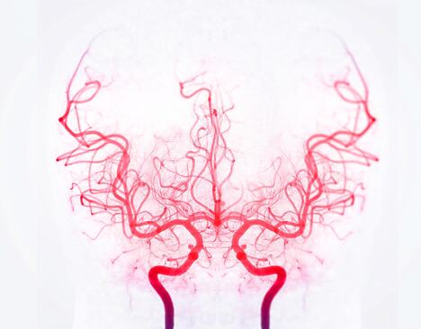 Bazilarna arterija