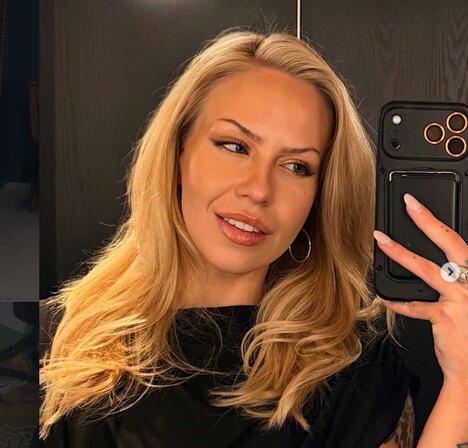 Finska influenserka Olivija Oras koja je preminula u 27. godini nakon estetskog zahvata (1).PNG